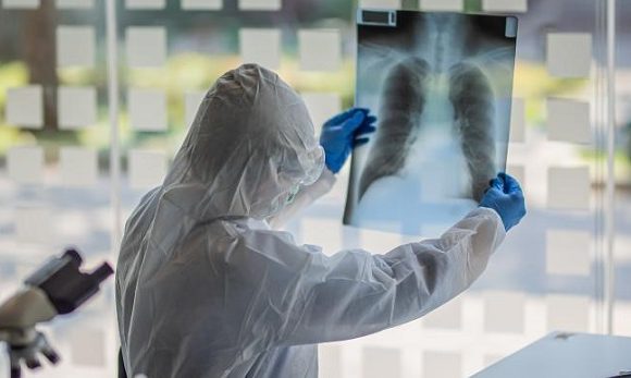 1.309 cazuri noi de COVID-19 in Romania