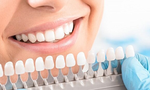 Implant dentar Fast and Fixed – Bucuresti [ preturi/ce inseamna ]